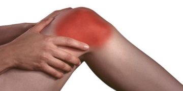 sport e artrite reumatoide