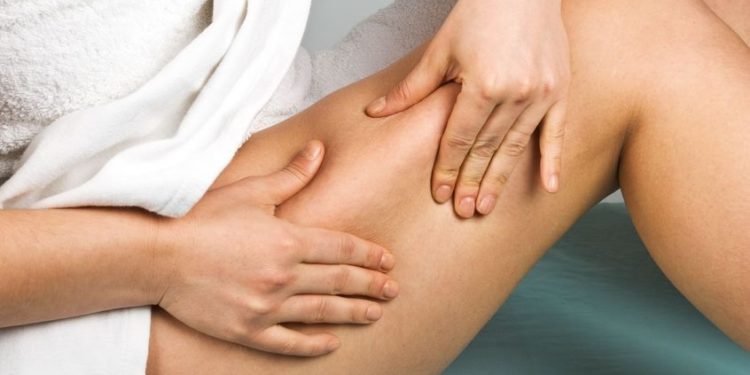 cellulite in menopausa