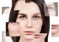 Acne-in-menopausa-e-perimemopausa